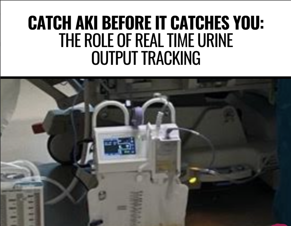 Catch AKI Before It Catches You: The Role of Real-Time UO Tracking